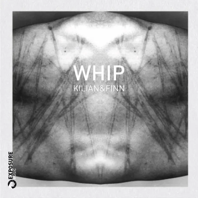 Whip - Black Loops Remix