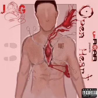 Open Heart by Jig