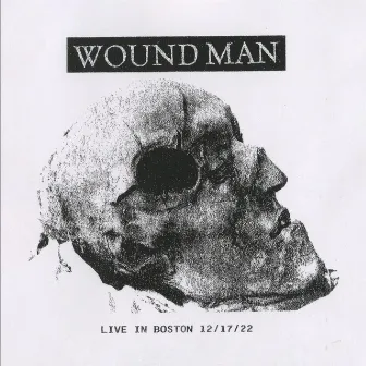 Live In Boston 12/17/22 by Wound Man