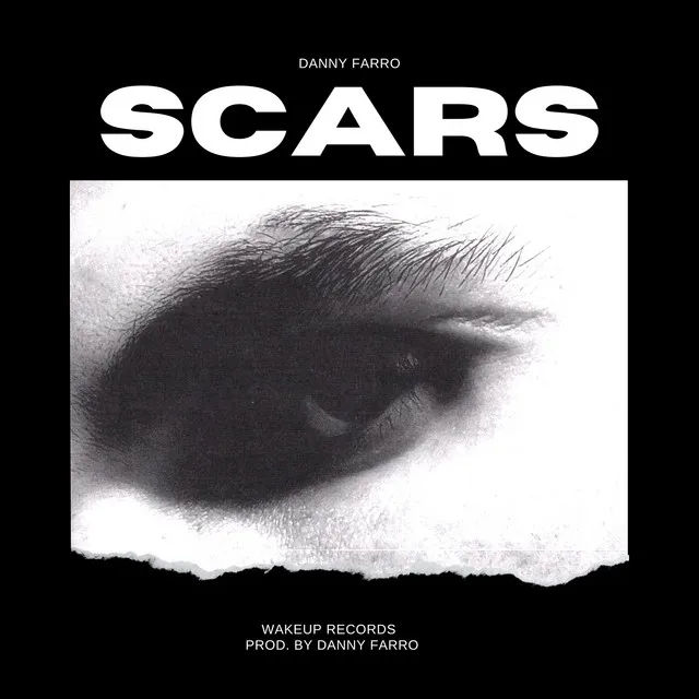 Scars