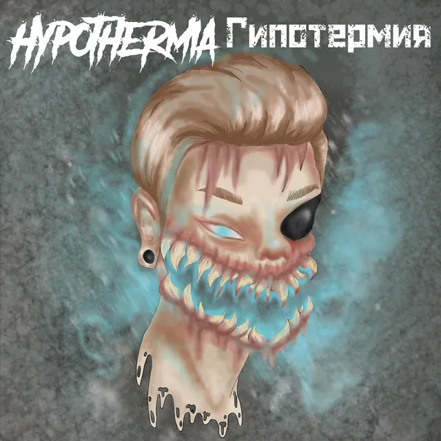 Hypothermia