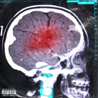 Bad Brainz by Rintor Beats