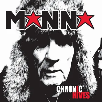 Chronic Hives by Manna