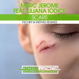 Scars (Fischer & Miethig Remixes) by Marc Jerome