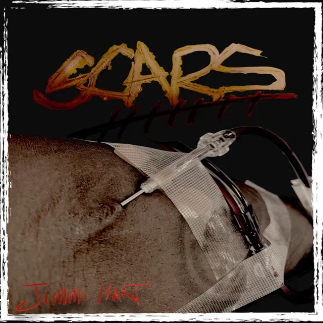 Scars