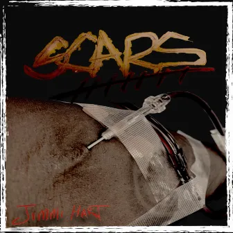 Scars by Jimmi Hart