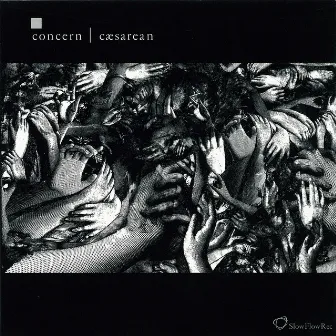 Cæsarean by Concern