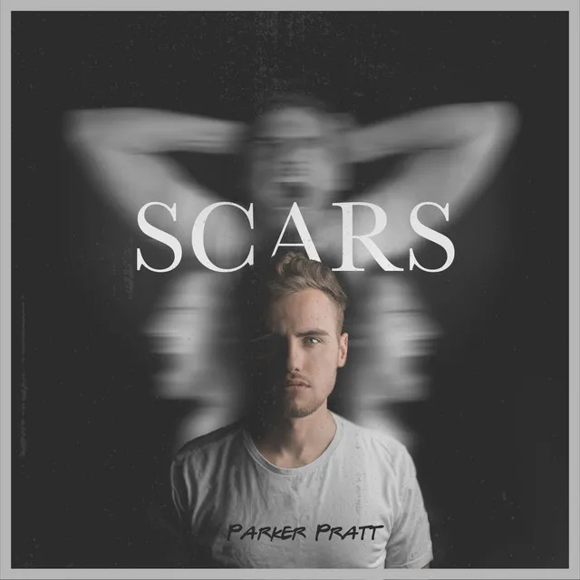 Scars