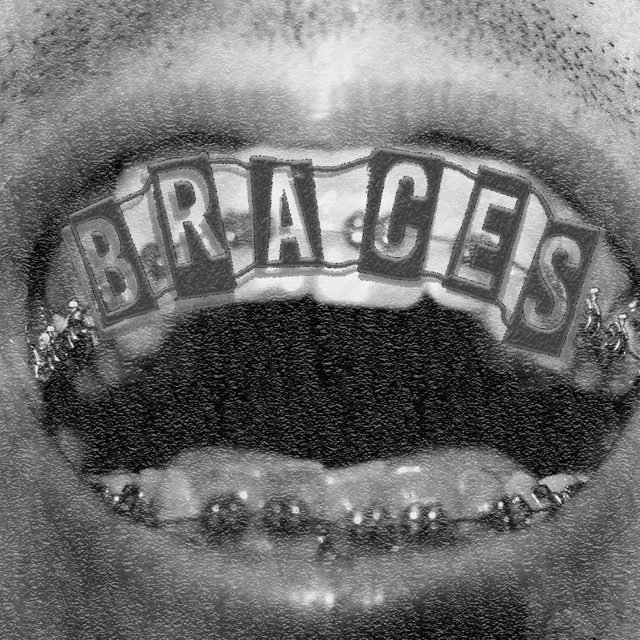 BRACES