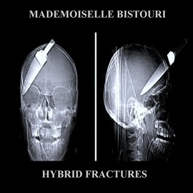 Hybrid Fractures, Pt. 1.