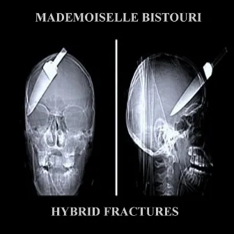 Hybrid Fractures by Mademoiselle Bistouri