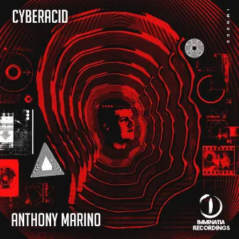 Cyberacid by Anthony Marino