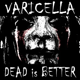 Dead Is Better by Varicella