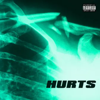 Hurts by Jiida