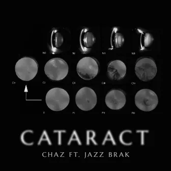 Cataract by Chaz