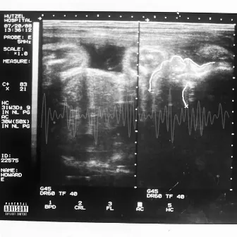 Ultrasound by Armani Monté