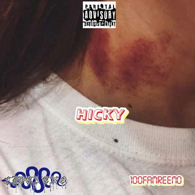 Hicky