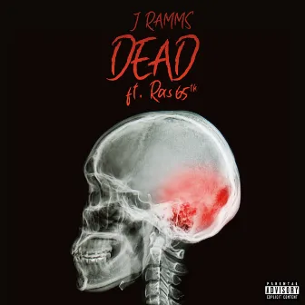 Dead by J Ramms