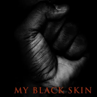 My Black Skin by Justin Fraley