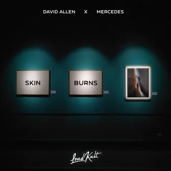 Skin Burns by Mercedes