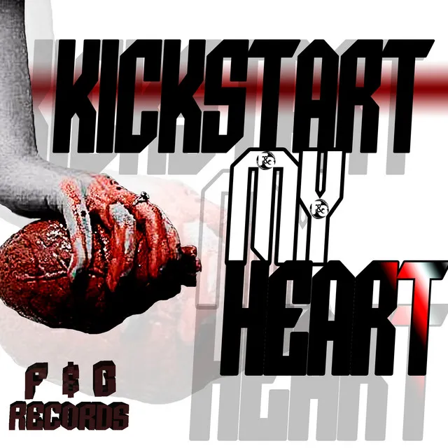 Kickstart My Heart - Original Mix