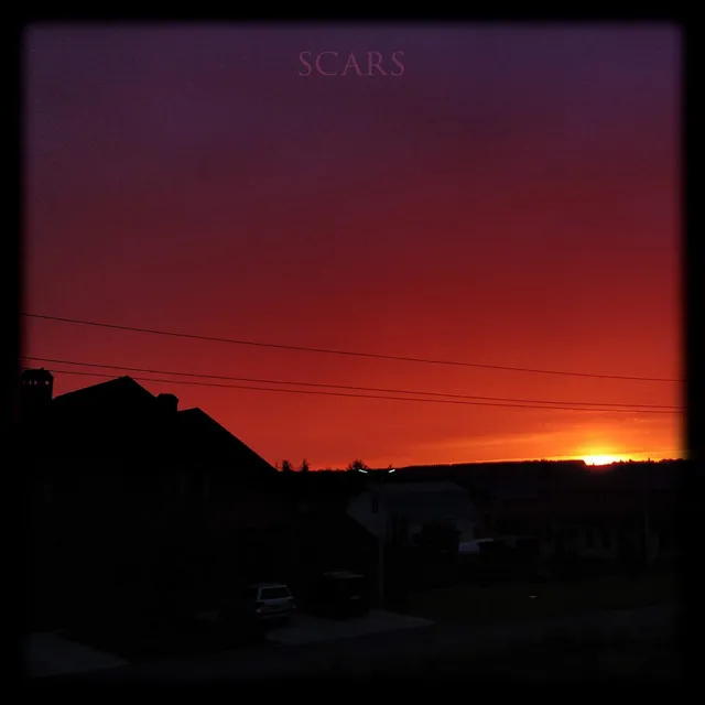 Scars