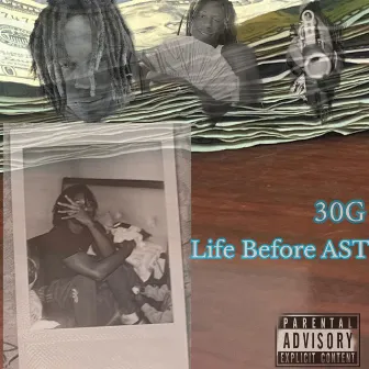 Life Before AST by 30G