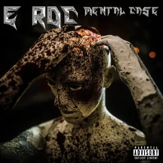 Mental Case by E-Roc