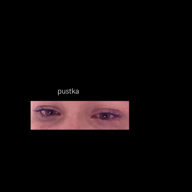 Pustka