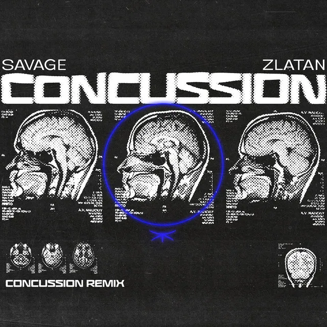 Concussion - Remix