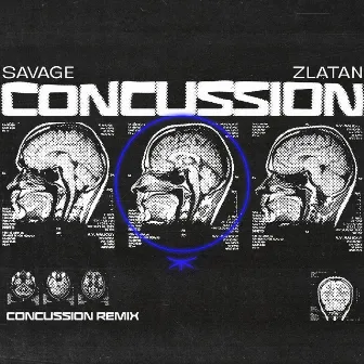 Concussion (Remix) by Savage