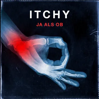 Ja als ob by ITCHY