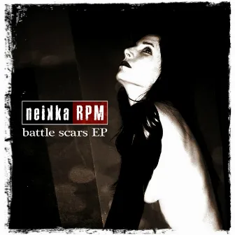 Battle Scars by Neikka RPM