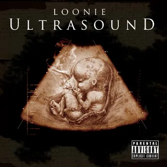 Ultrasound by Loonie