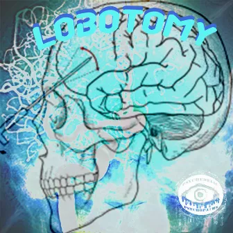 Lobotomy by ZodiacJack