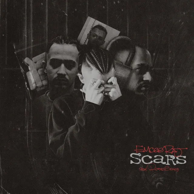 Scars