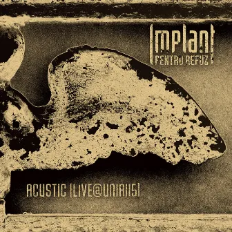 Acustic (Live@unirii5) by Implant Pentru Refuz