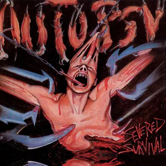 Severed Survival by Autopsy