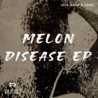 Melon Disease EP by Luca Maier