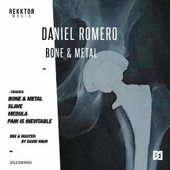 Bone and Metal by Daniel Romero