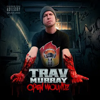 Open Woundz by Trav Murray