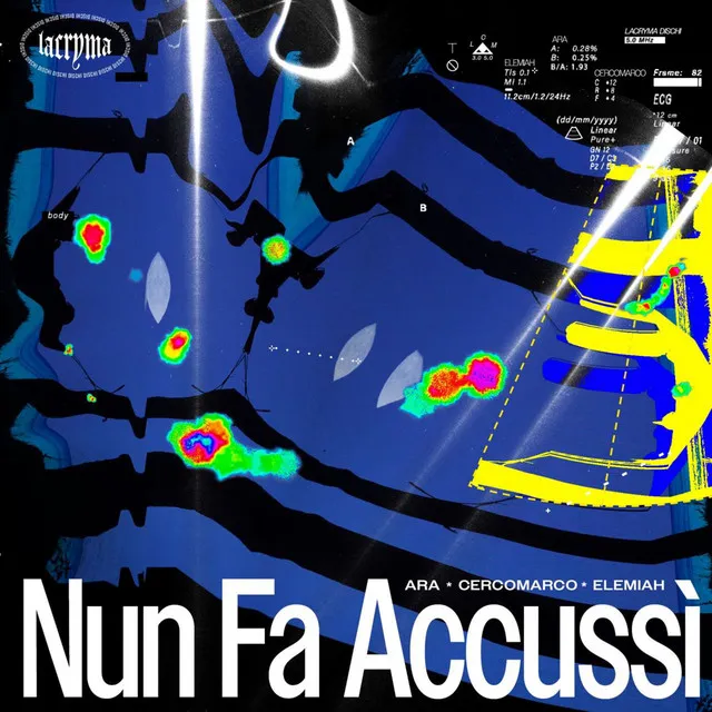 NUN FA ACCUSSÌ