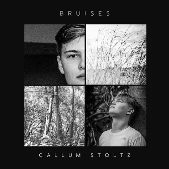 Bruises by Callum Stoltz