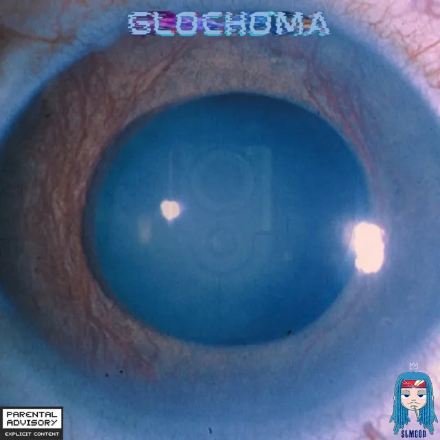 Glochoma