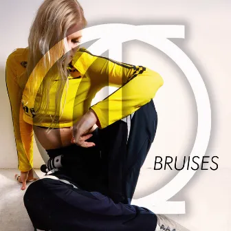 Bruises by CRONICLE