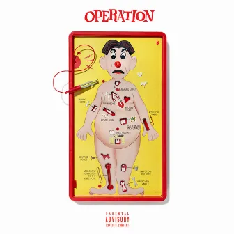 Operation by JJ