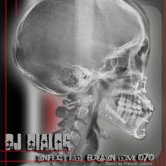 Infected Brain by Dj Dialog