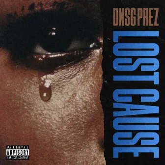 Lost Cause by Dnsg Prez