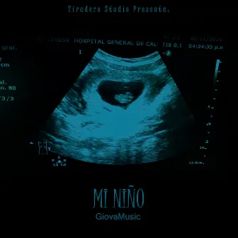 Mi Niño by GiovaMusic