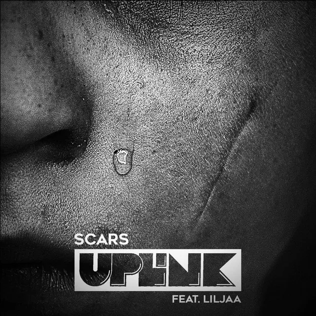 Scars